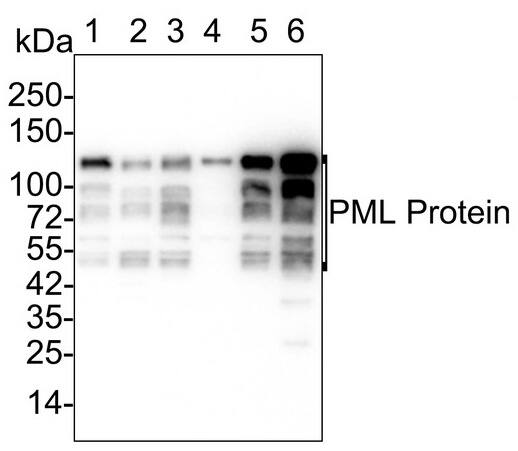 PML Protein Antibody (PSH02-89)