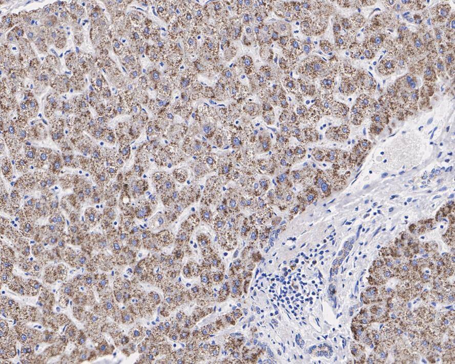 PMP70 Antibody (JE39-00)