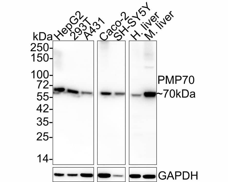 PMP70 Antibody (PSH03-27) Western Blot: PMP70 Antibody (PSH03-27) [NBP3-32834]