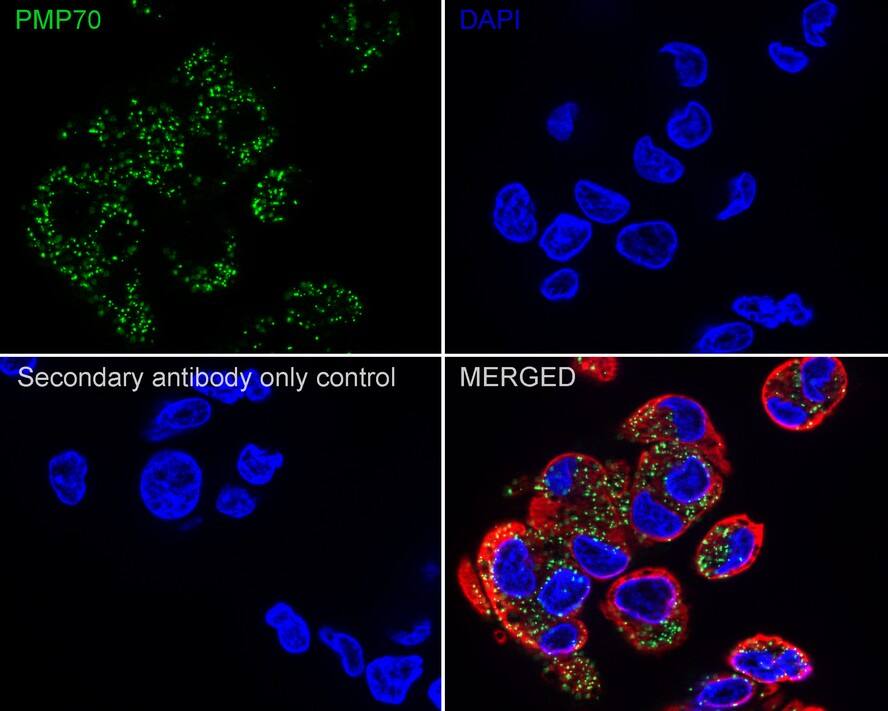 PMP70 Antibody (PSH03-27)