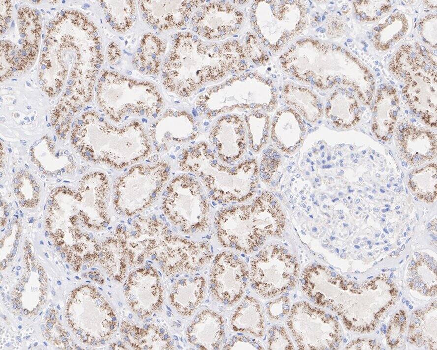 PMP70 Antibody (PSH03-27)