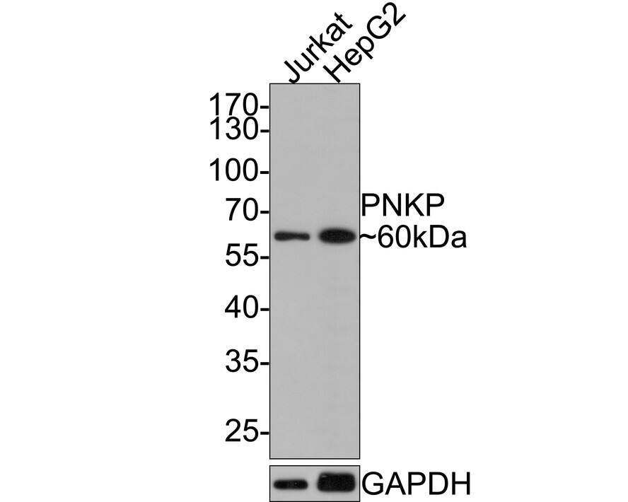 PNK Antibody (JE64-21)