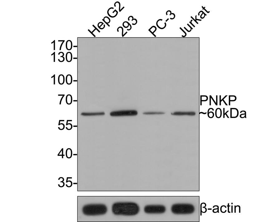 PNK Antibody (JE64-85)