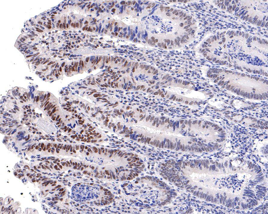 PNK Antibody (JE64-85)