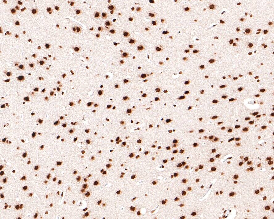 SAFB Antibody (JE64-94)