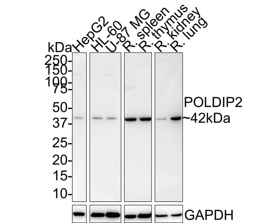 POLDIP2 Antibody (PSH01-20)