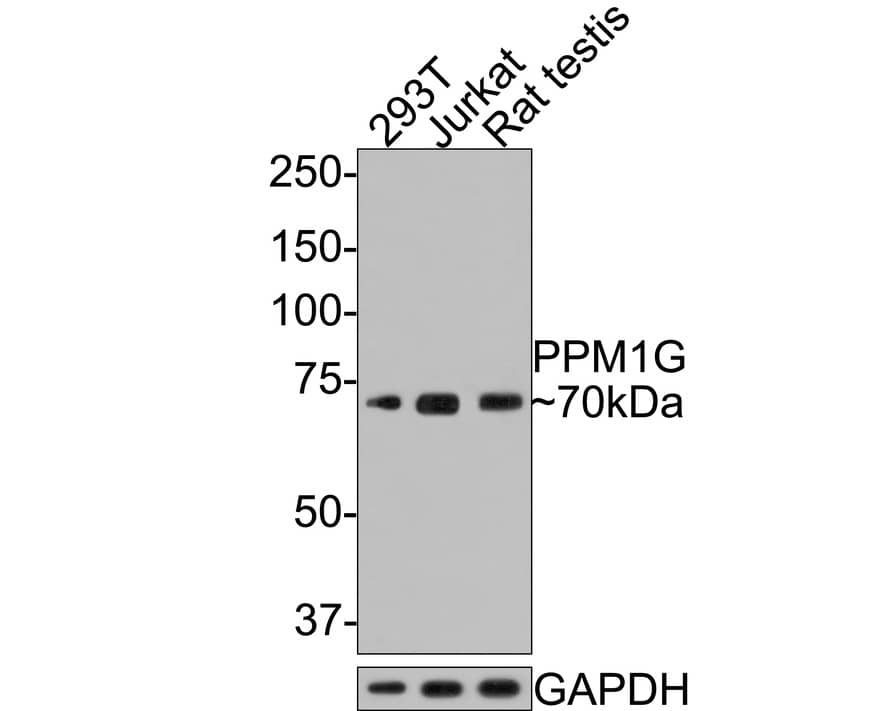 PP2C gamma/PPM1G Antibody (JE64-91)