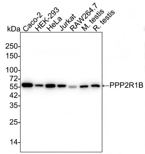 PPP2R1B Antibody (PSH02-92) Western Blot: PPP2R1B Antibody (PSH02-92) [NBP3-32845]