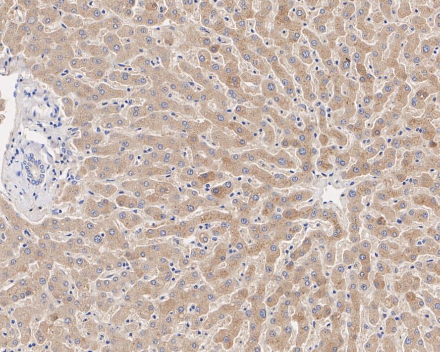 PPP2R1B Antibody (PSH02-92)