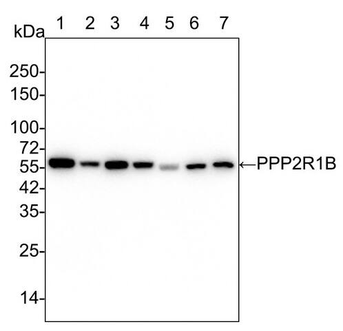 PPP2R1B Antibody (PSH02-92)