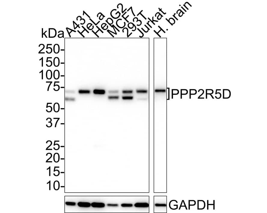PPP2R5D Antibody (PSH01-21) Western Blot: PPP2R5D Antibody (PSH01-21) [NBP3-32846]