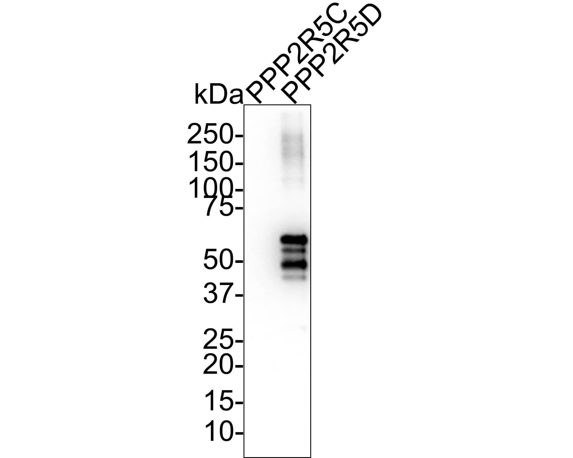 PPP2R5D Antibody (PSH01-21) Western Blot: PPP2R5D Antibody (PSH01-21) [NBP3-32846]