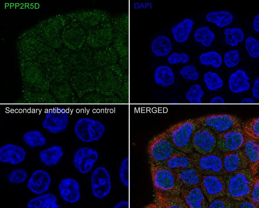 PPP2R5D Antibody (PSH01-21)