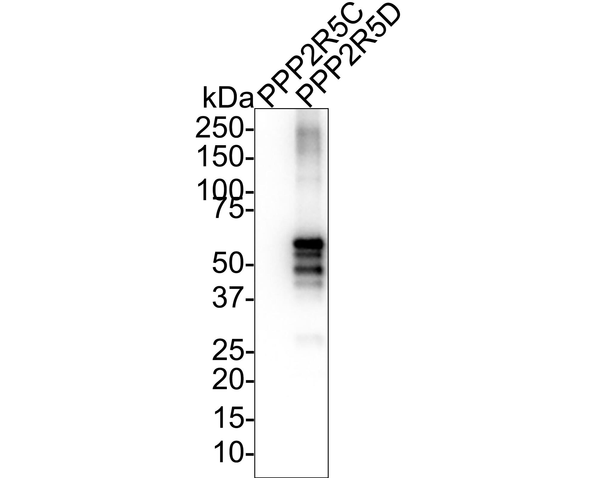 PPP2R5D Antibody (PSH01-22) Western Blot: PPP2R5D Antibody (PSH01-22) [NBP3-32847]