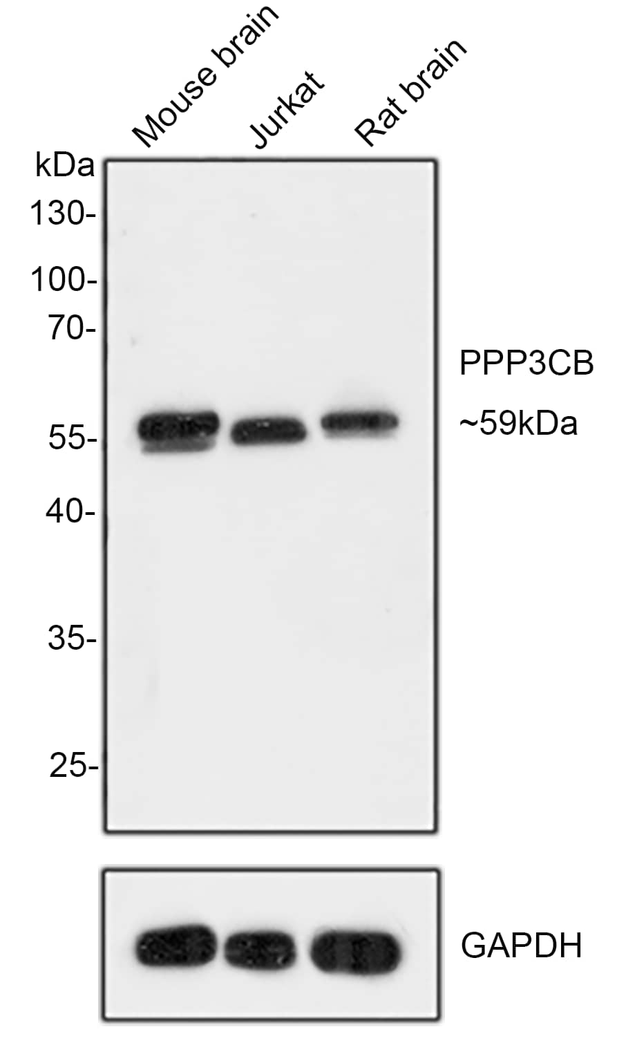 PPP3CB Antibody (PSH0-21)