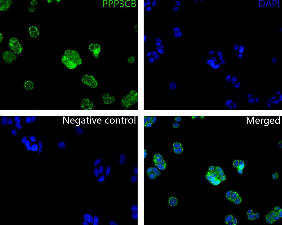 PPP3CB Antibody (PSH0-21)