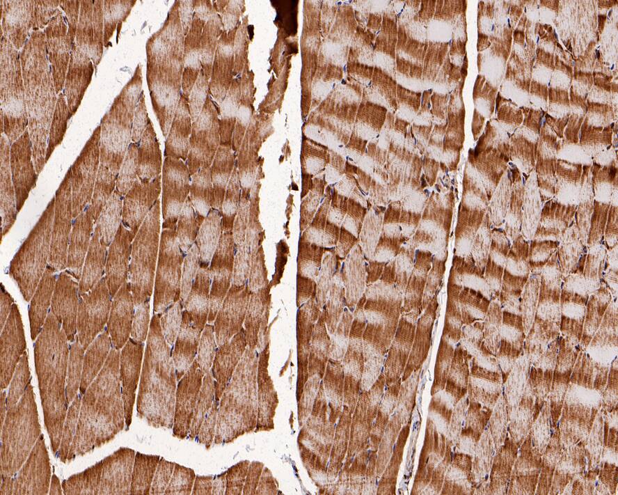 PPP3CB Antibody (PSH0-21)