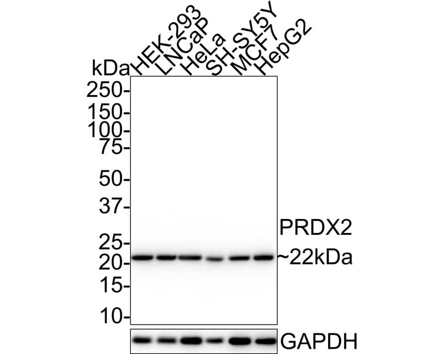 Peroxiredoxin 2 Antibody (7F5-R)