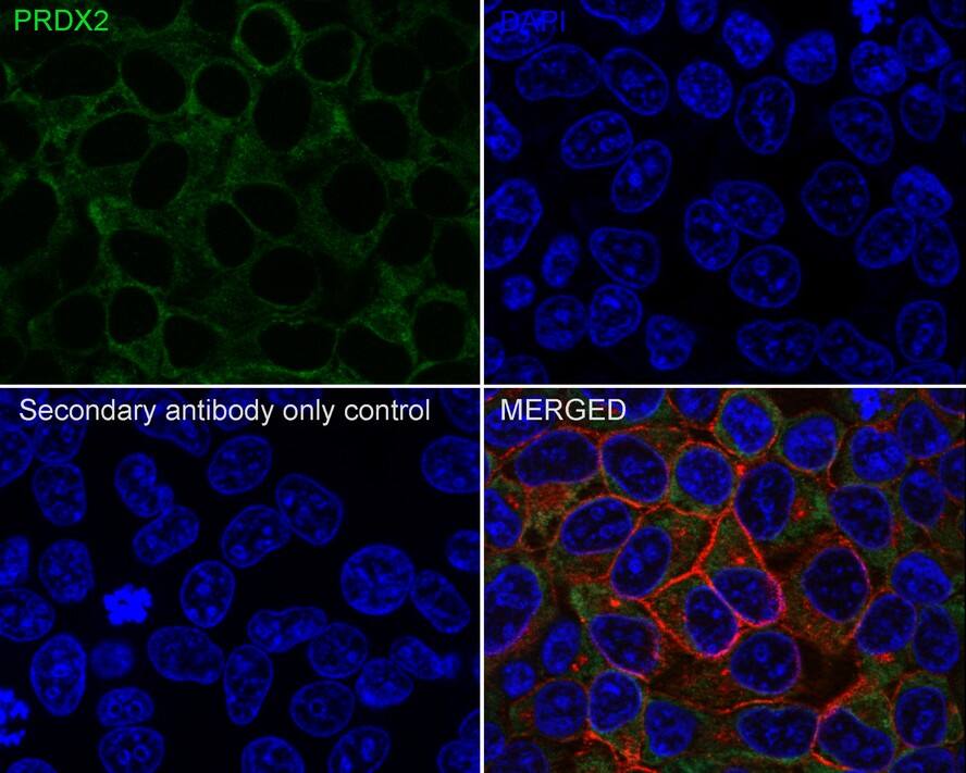 Peroxiredoxin 2 Antibody (7F5-R)