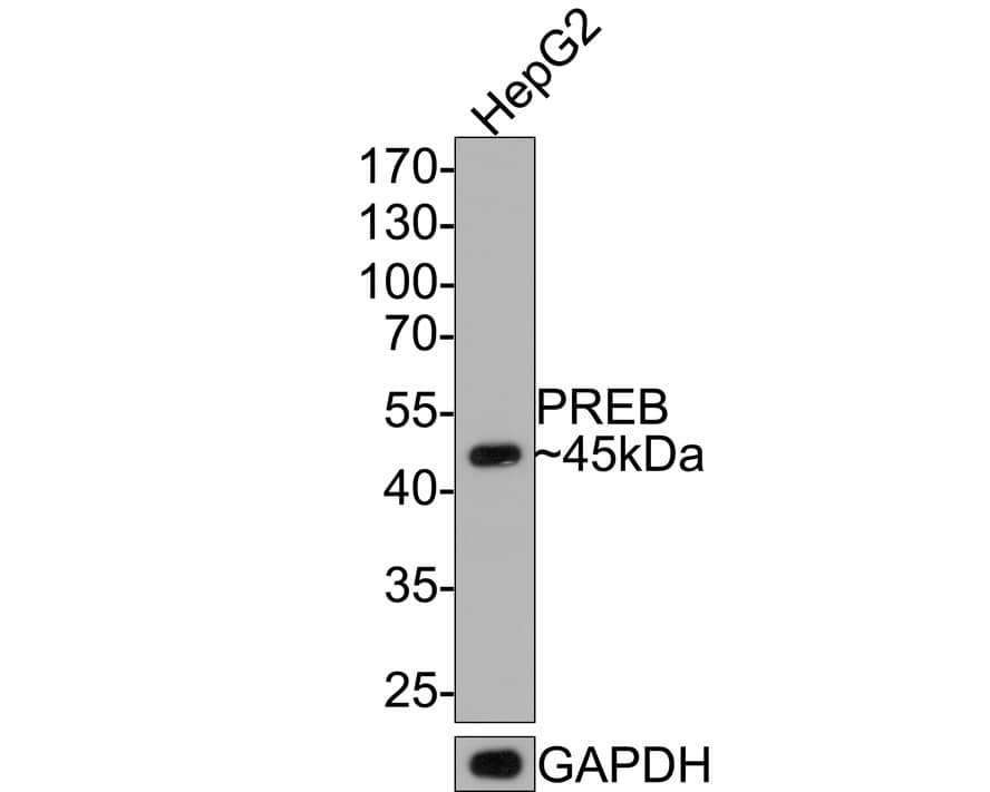 PREB Antibody (JE64-56)