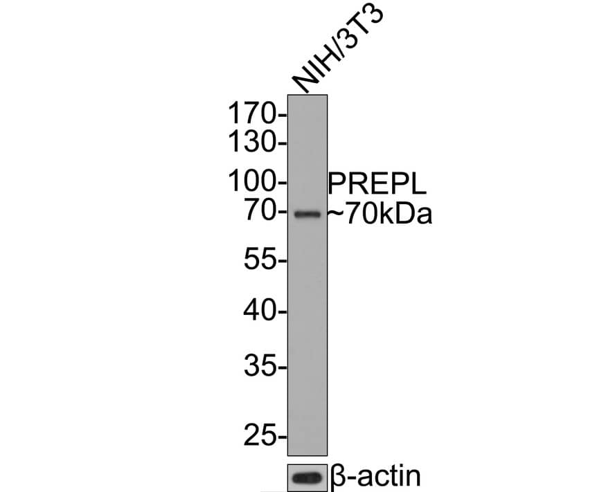 Prolyl endopeptidase-like Antibody (JE65-64)