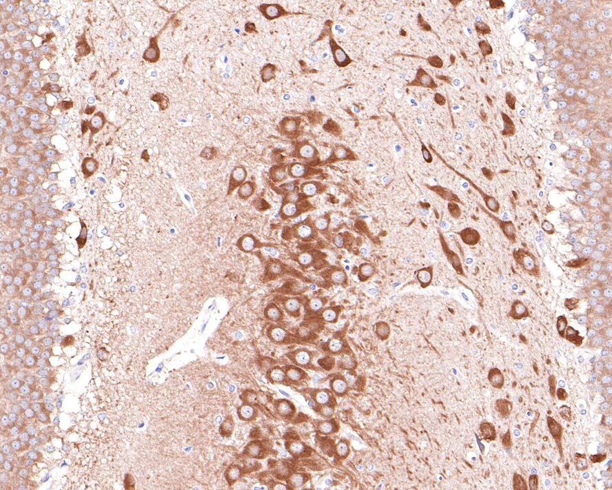 Prolyl endopeptidase-like Antibody (JE65-64)