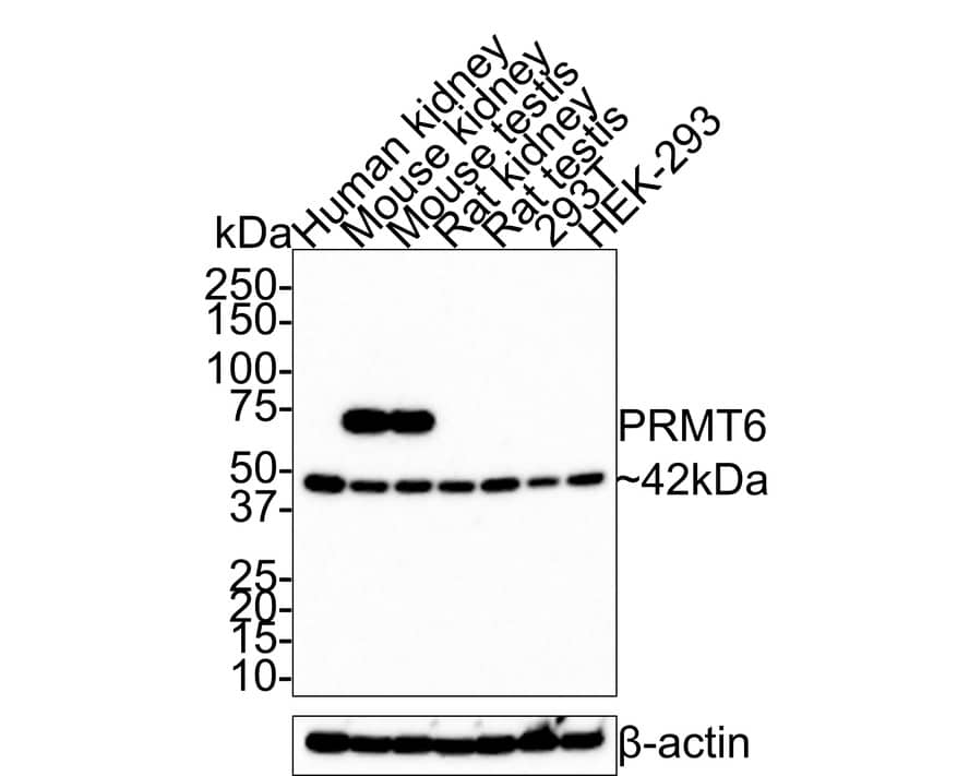 PRMT6 Antibody (JE36-57)