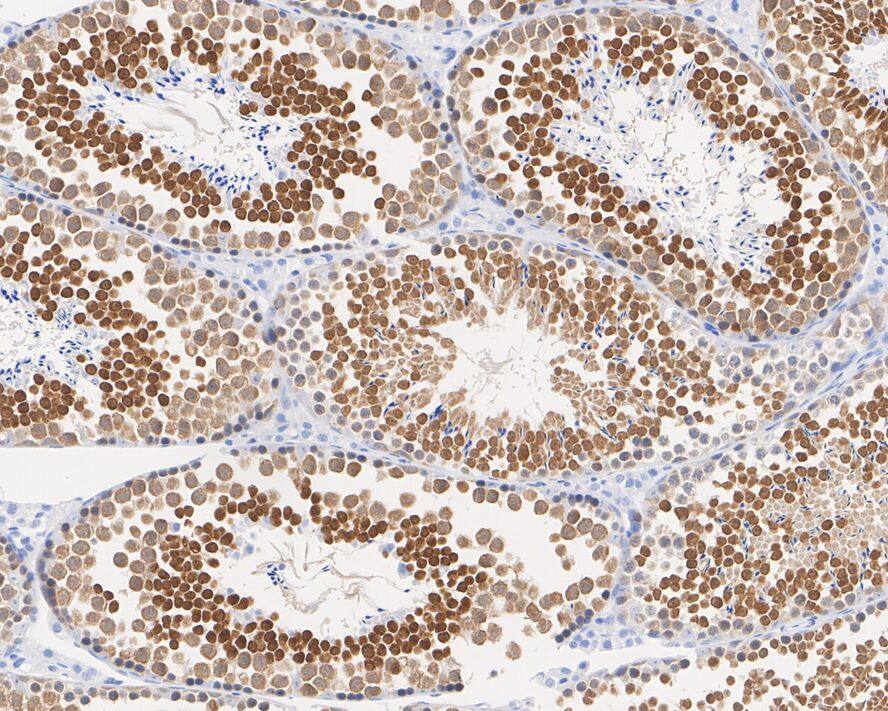 PRMT7 Antibody (JE64-78)