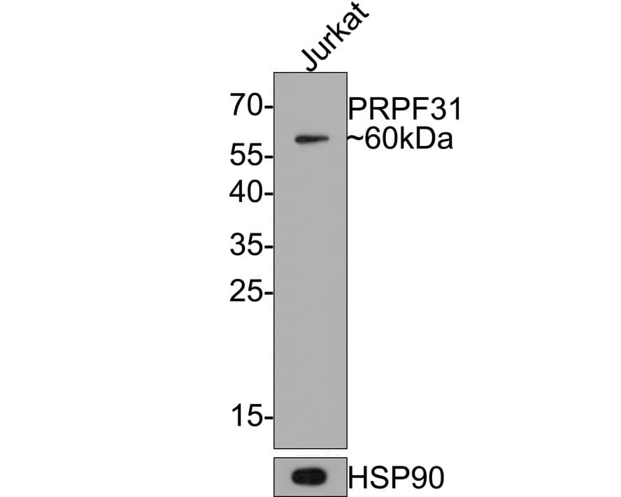 PRPF31 Antibody (JE64-82)