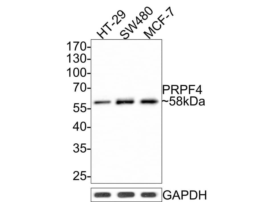 PRPF4 Antibody (JE65-37)