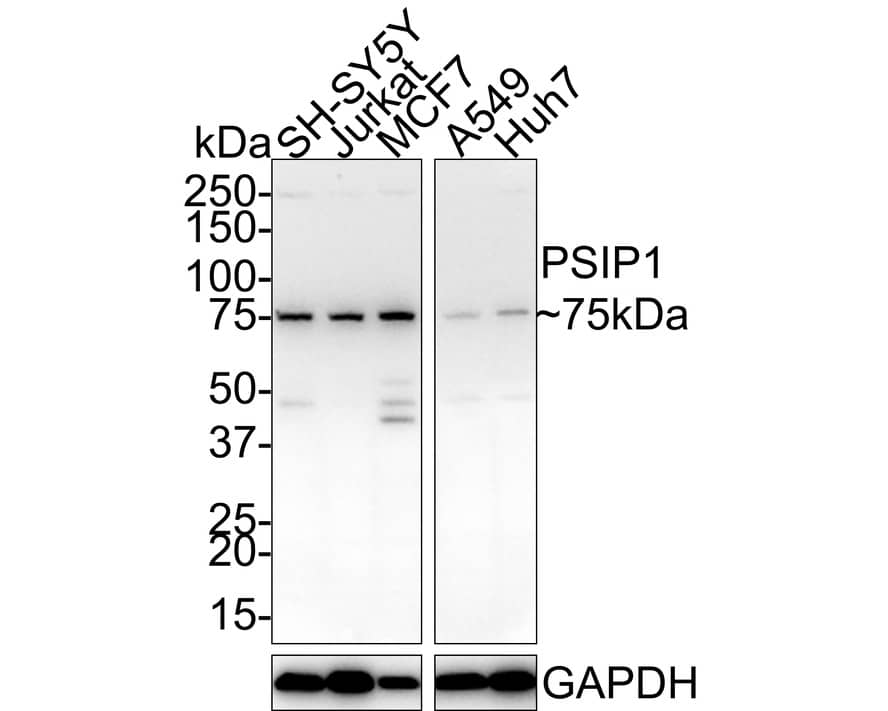 LEDGF Antibody (JE75-02)