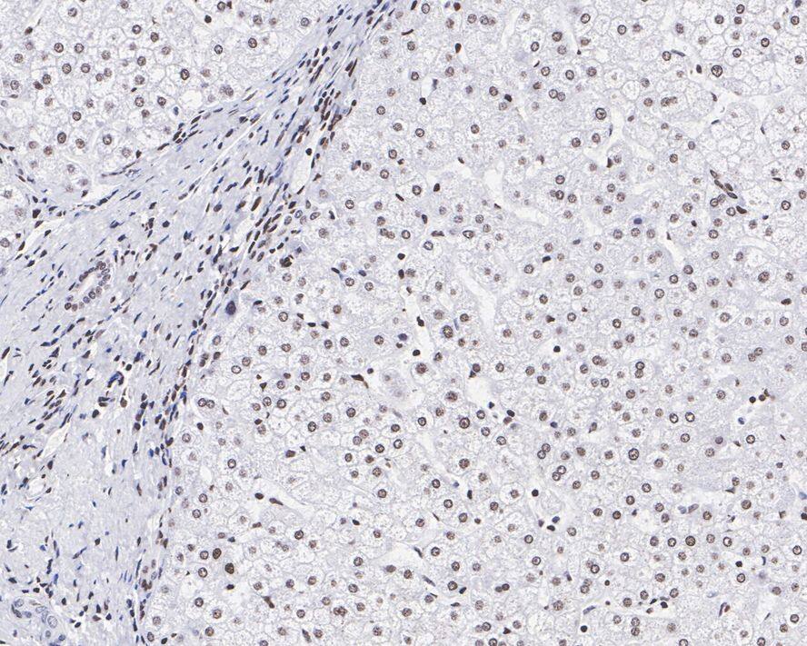 LEDGF Antibody (JE75-02)