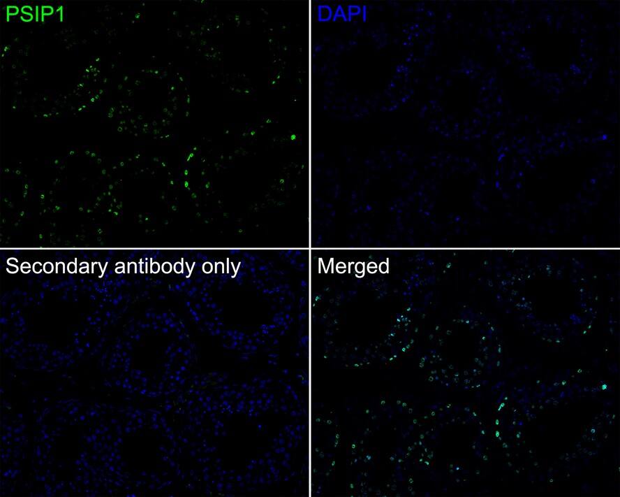 LEDGF Antibody (PSH02-55)