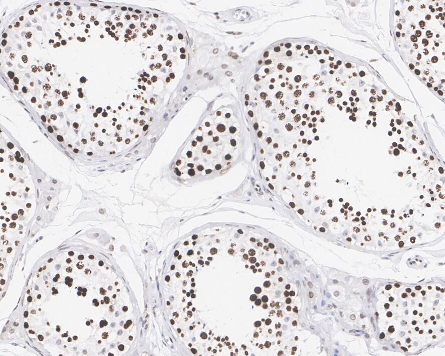LEDGF Antibody (PSH02-55)