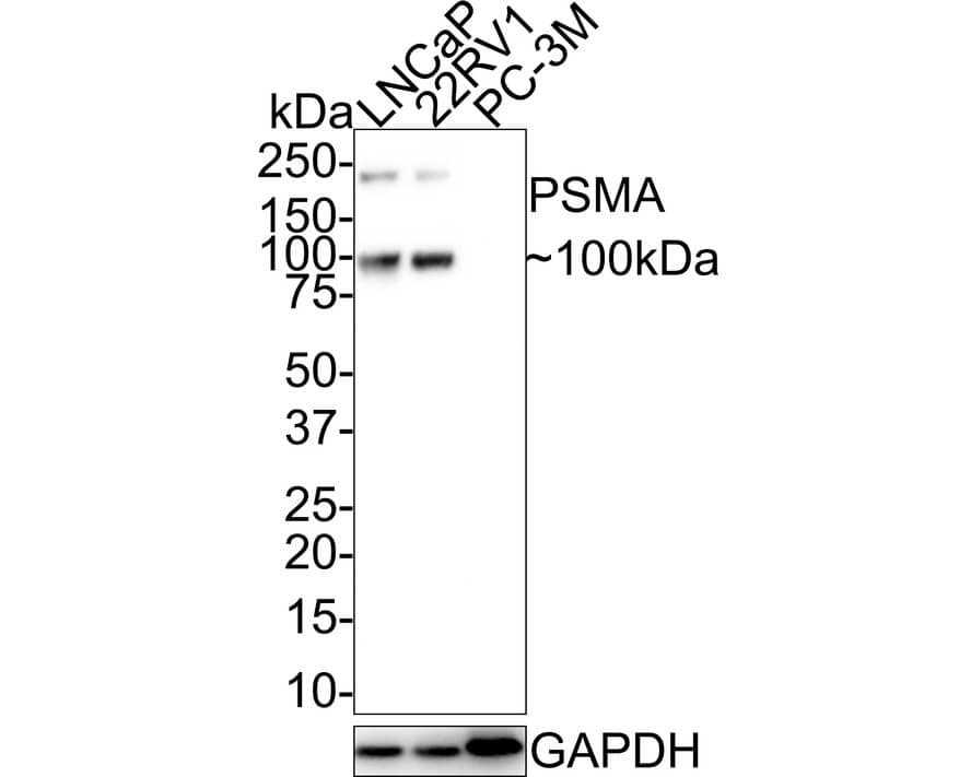 PSMA/FOLH1/NAALADase I Antibody (JE42-45)