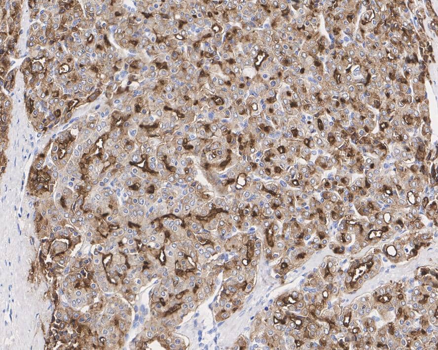 PSMA/FOLH1/NAALADase I Antibody (JE42-45)