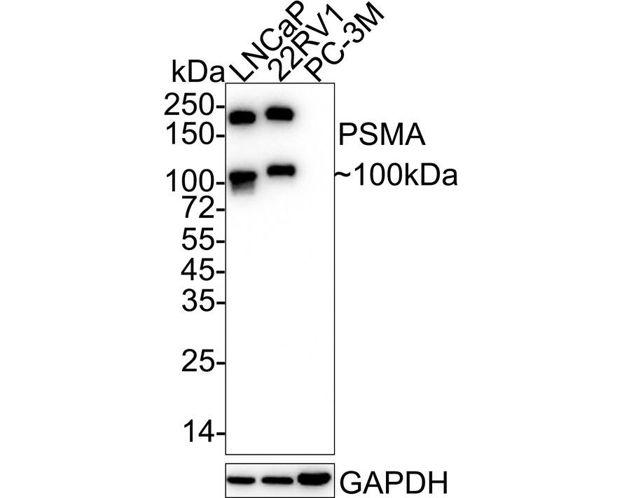 PSMA/FOLH1/NAALADase I Antibody (PD00-72)