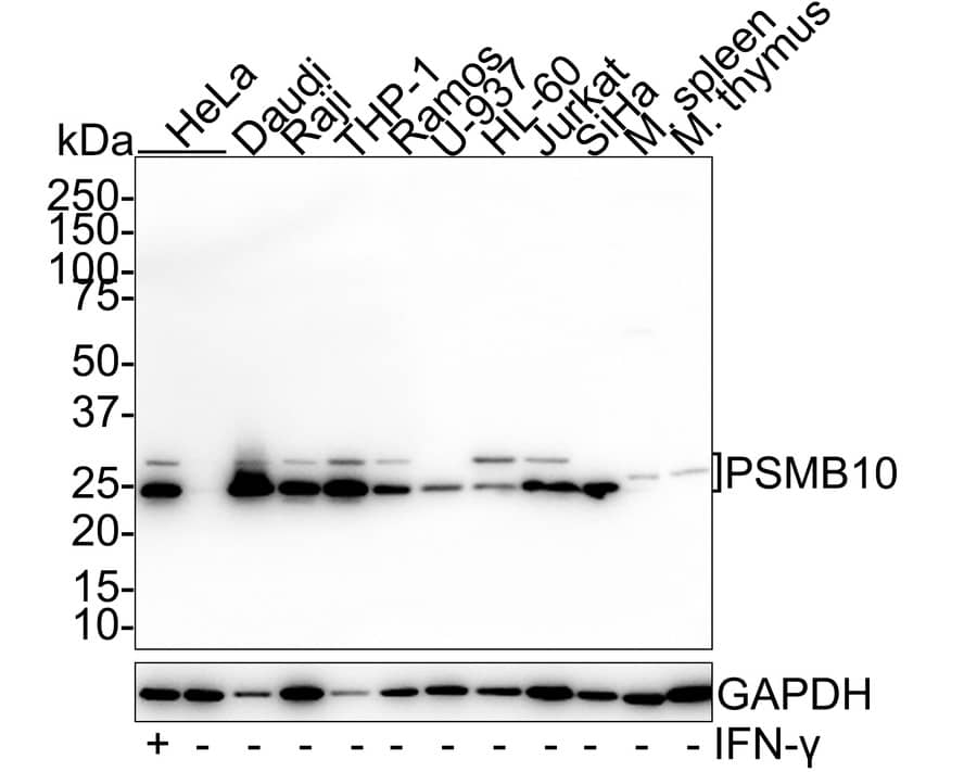 PSMB10/MECL1 Antibody (PSH01-58)