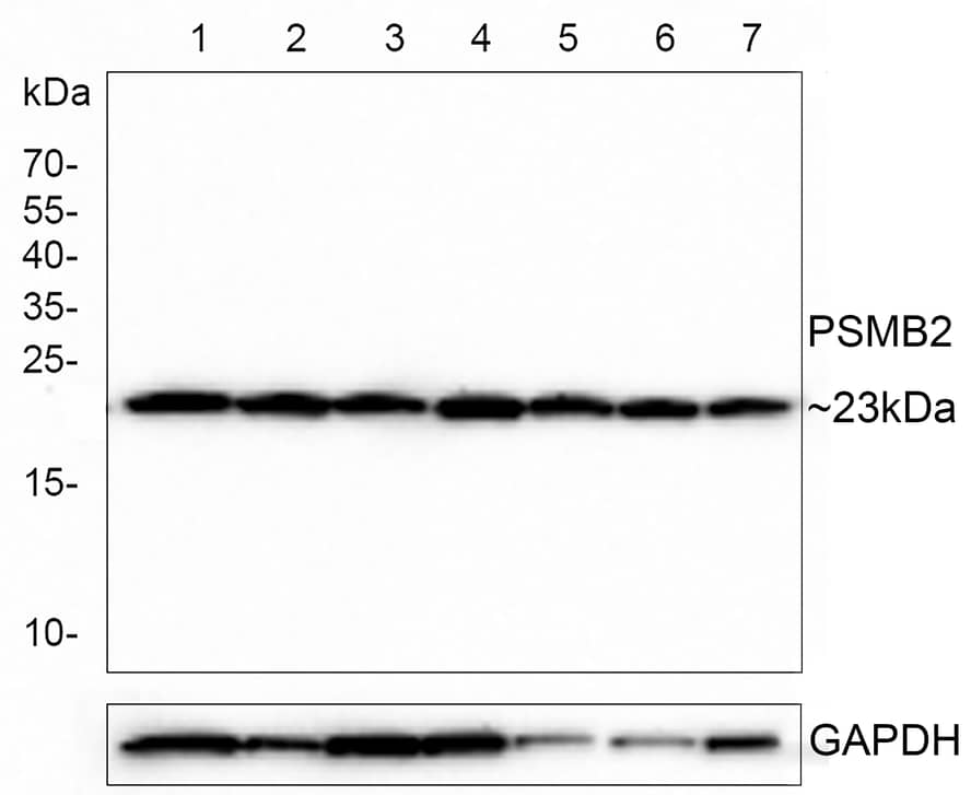 Proteasome 20S beta2 Antibody (PSH0-28)