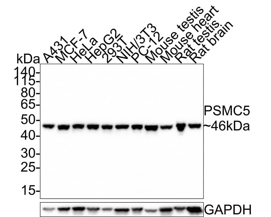 SUG1 Antibody (PSH0-22)