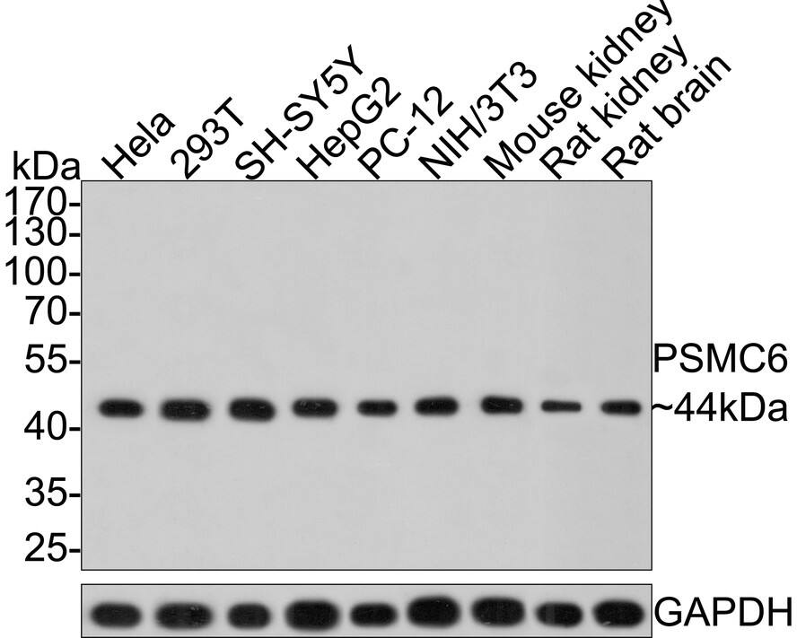 PSMC6 Antibody (PSH0-12)