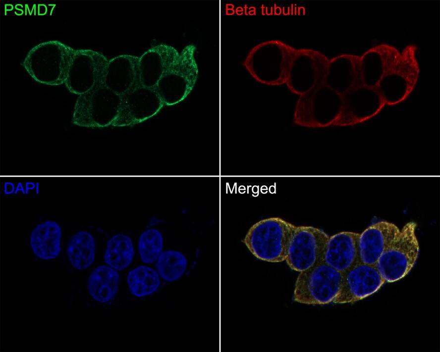 PSMD7 Antibody (PSH01-83)