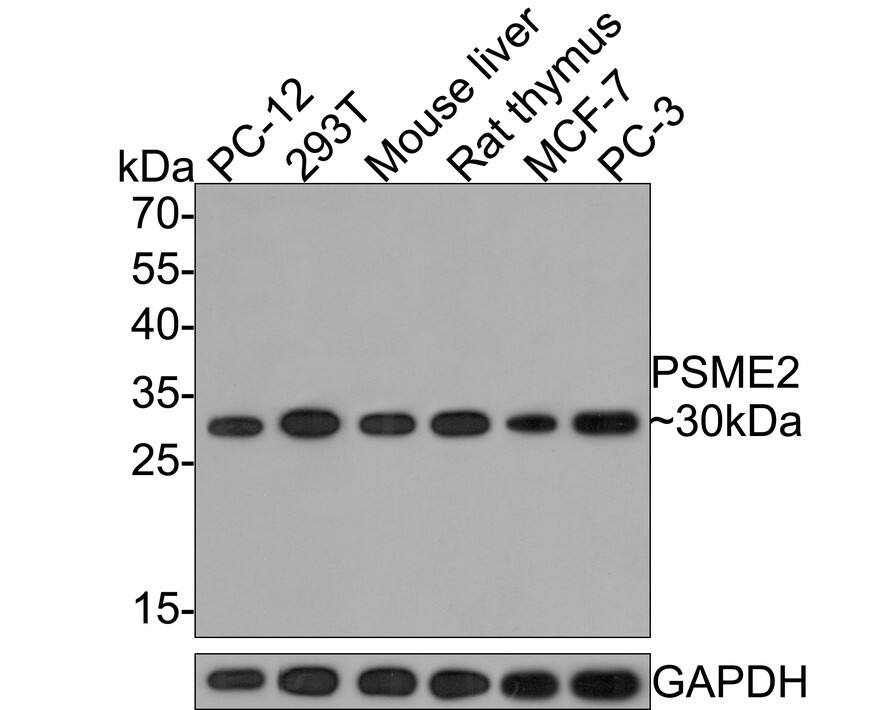 PA28 Activator beta Subunit/PSME2 Antibody (PSH0-10)