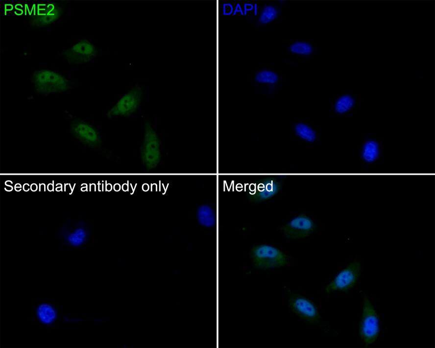 PA28 Activator beta Subunit/PSME2 Antibody (PSH0-10)