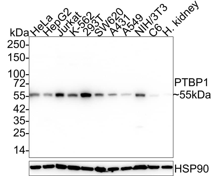 PTBP1 Antibody (5C1-R)