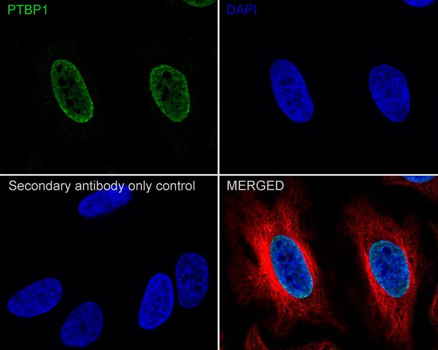 PTBP1 Antibody (5C1-R)