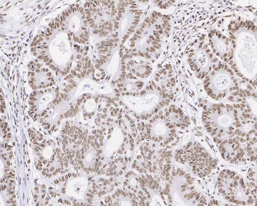 PTBP1 Antibody (5C1-R)