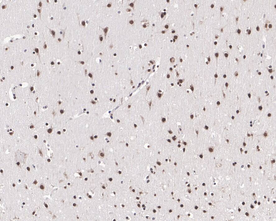 PTBP2 Antibody (JE66-55)