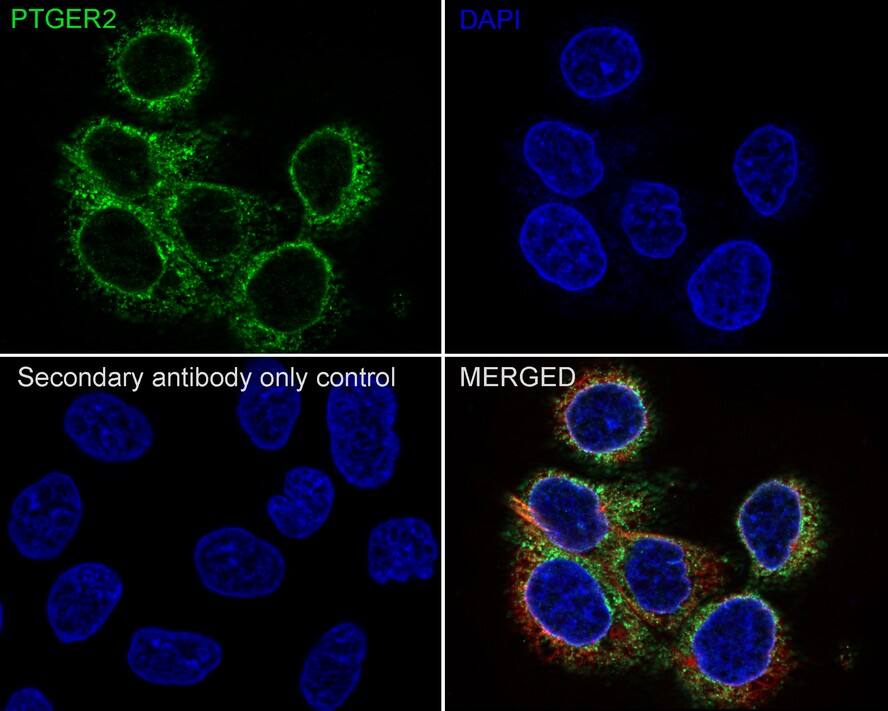 PTGER2 Antibody (JE30-72)