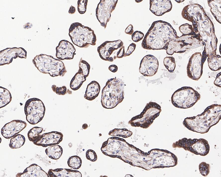 PTGER2 Antibody (JE30-72)